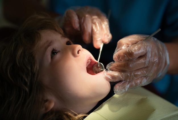 Close-up tandarts procedure van kinderen tanden een kind jongen met een tandarts in een tandartspraktijk kinderen orthodont