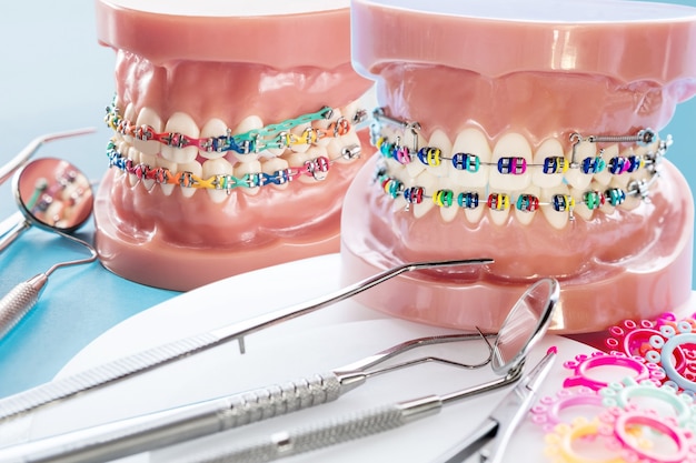Foto close-up tandarts tools en orthodontisch model - demonstratie tanden model van verschillende orthodontische beugel of brace