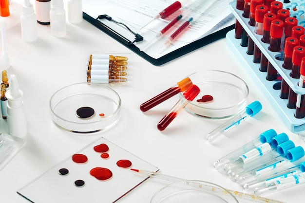 Close-up of test tubes arranged on a table in medical laboratory