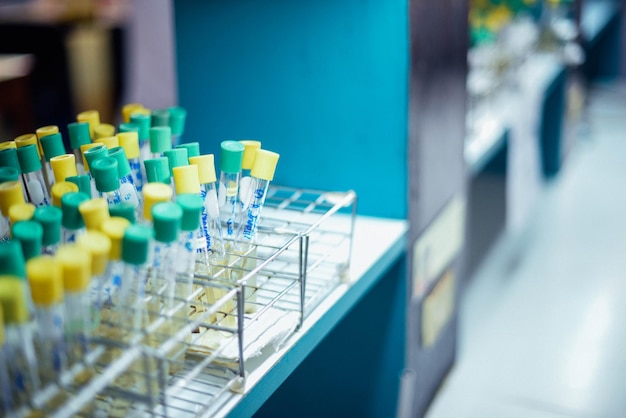 close-up of test tubes in rack at laboratory