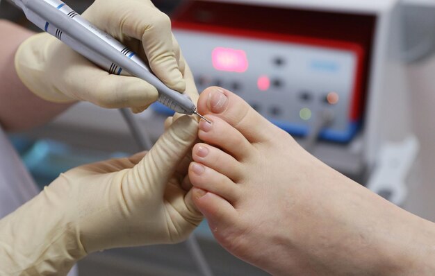 Photo close up toenails foot care spa concept