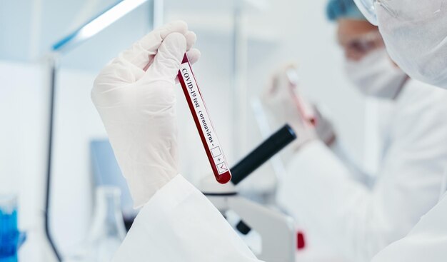 Close up tube with the test in the hands of a medic