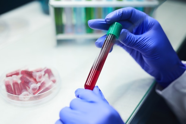 Close up of unrecognizable scientist holding test tube with blood sample while working on research in laboratory, copy space