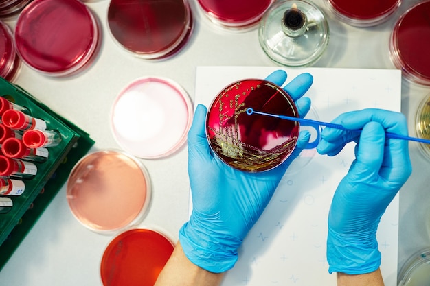 Close-up van biochemicus die petrischaal in blauwe wegwerphandschoenen bij biotechnolaboratorium houdt