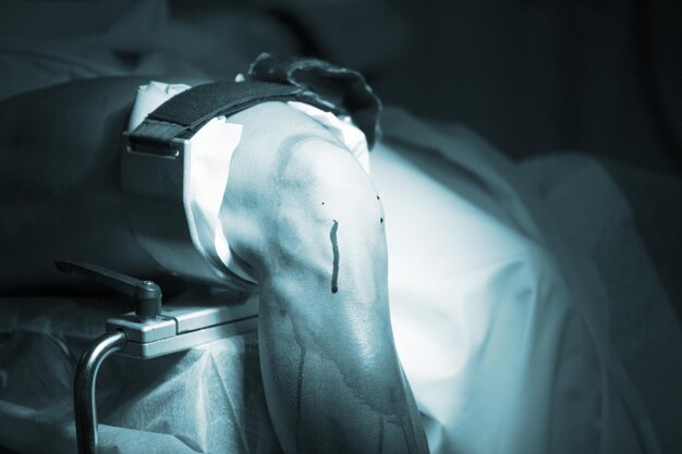 Foto close-up van de gewonde knie van een patiënt in de operatiekamer