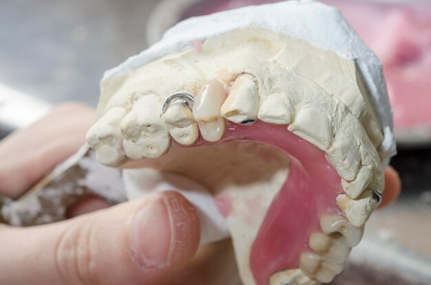 Close-up van de hand van een tandarts