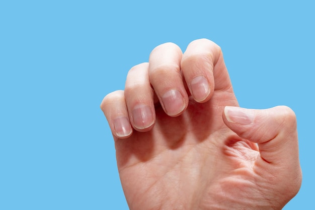 Close-up van een blanke vrouwelijke hand met natuurlijke ongepolijste nagels overwoekerde nagelriemen op blauwe achtergrond