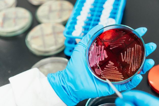 Close-up van een chemicus die een lus gebruikt om een monster uit een petrischaal in het laboratorium te nemen.