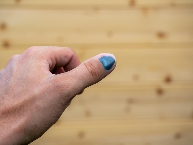 Close-up van een geslagen duim. Wazig houten achtergrond op de achtergrond. Letsel op het werk, blauwe plek, hematoom. Selectieve focus