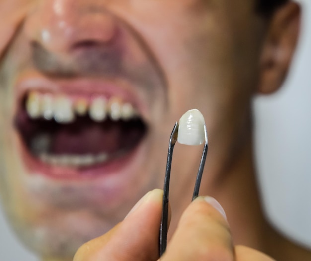 Foto close-up van een man die tanden vasthoudt