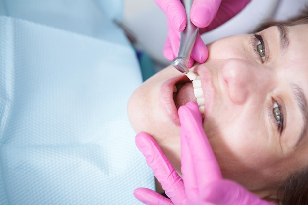 Close-up van een volwassen vrouw die haar tanden professioneel laat reinigen door haar tandarts