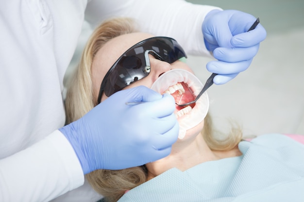 Close up van een vrouw die tandheelkundige behandeling krijgt op het kantoor van tandartsen