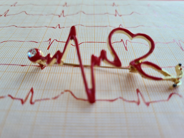 Close-up van elektrocardiogram in papieren vorm hartaanval