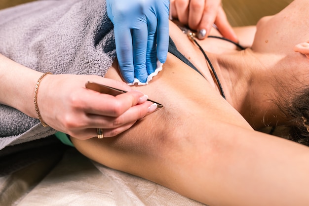 Close-up van het verwijderen van okselhaar met een pincet. Vrouwelijke ontharing. Cosmetologie en schoonheidssalon