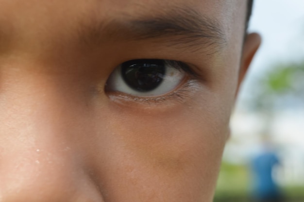 Foto close-up van jongen blauwe plekken rond de ogen