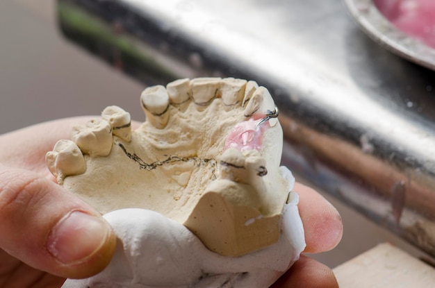 Close-up van prosthetische apparatuur