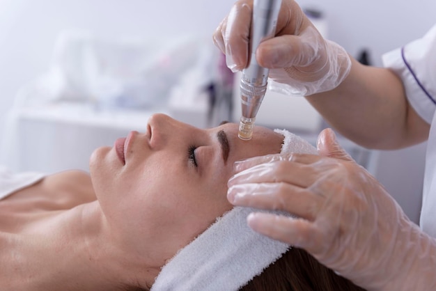 Close up van schoonheidsspecialist schoonheidsspecialiste gezichtsbehandeling dermapen toe te passen op gezicht van jonge vrouw klant in schoonheidssalonCosmetologie en professionele huidverzorging gezichtsverjonging