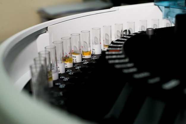 Foto close-up van testbuizen in een centrifuge in het laboratorium