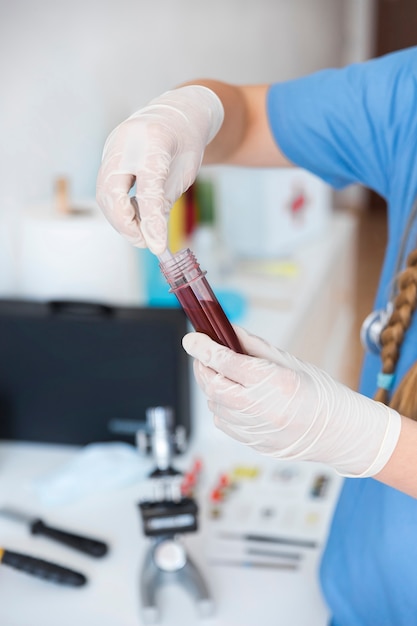 Foto primo piano di una mano del veterinario che lavora con il campione di sangue