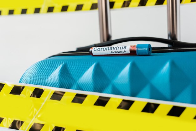 Photo close up view of blue suitcase with coronavirus blood sample in yellow and black hazard warning