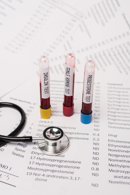 호르몬이 있는 목록에서 호르몬 및 인슐린 검사가 있는 청진기 및 테스트 튜브를 자세히 볼 수 있습니다.