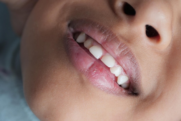 Foto chiuda in su dei denti bianchi di un bambino