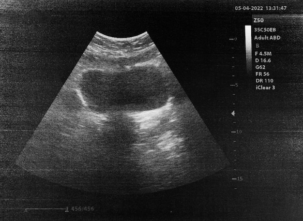 Photo a close-up with an ultrasound image