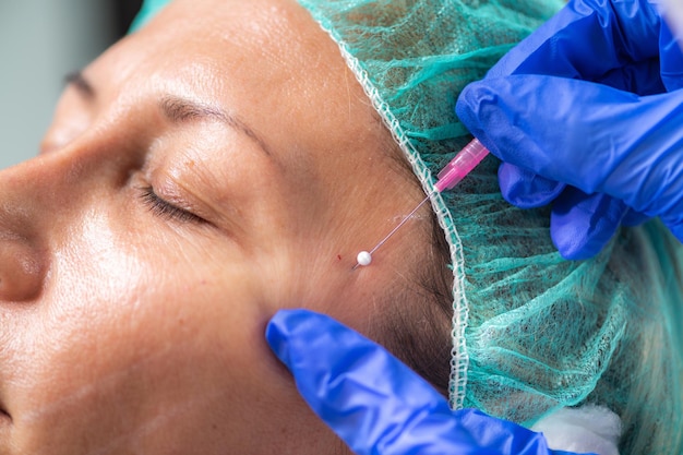 Photo close-up of woman during botox