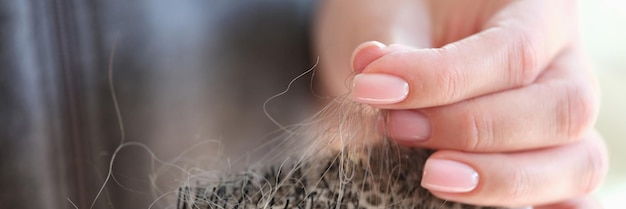 Крупный план женских рук держит расческу с большим количеством выпадения волос и нездоровой концепцией волос