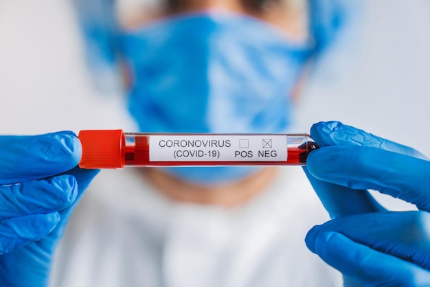 Close up of young male scientist holding test tube with blood sample for coronavirus negative