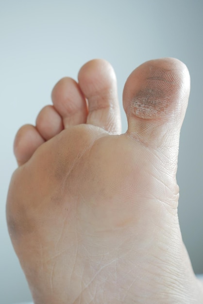 Close up of young men dry feet on bed