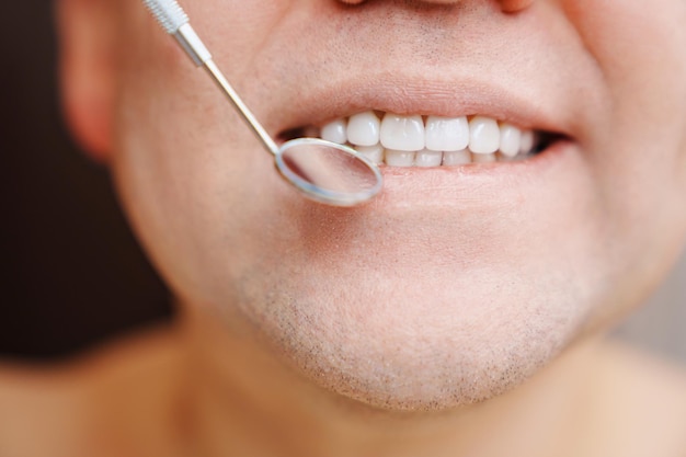 Close-uponderzoek van tanden met fineer met een speciale tandspiegel
