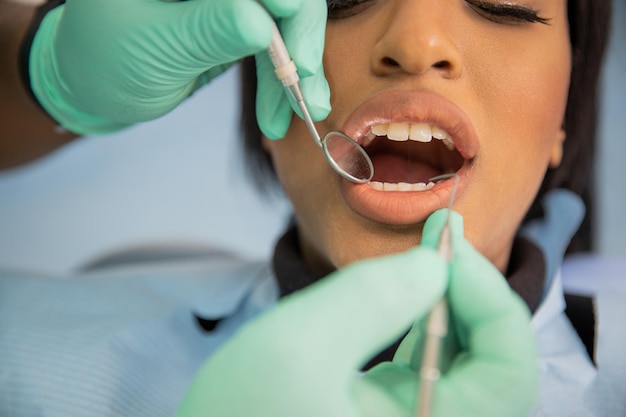 Closeup of an african patient39s mouth during a dental visit\
dental care concept