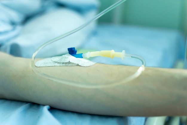 closeup of arm with needle inserted into arm and tube attached to the needle blood donation process the military hospital