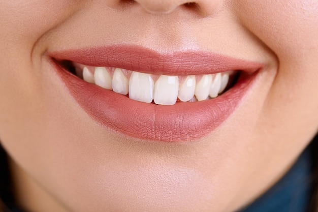 Foto primo piano bello sorriso della giovane donna. salute dentale. sbiancamento dei denti. concetto di restauro