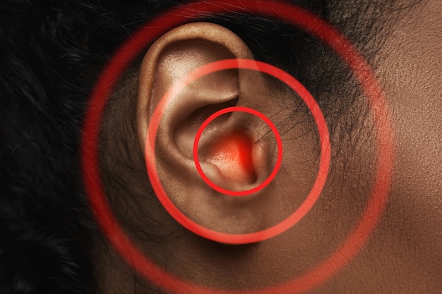 Closeup of black woman's ear with source of pain