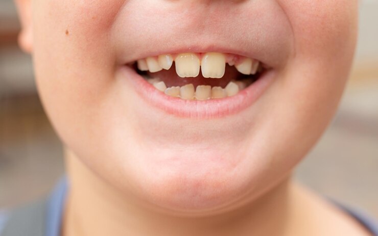 Premium Photo | Closeup of a boy showing a fallen tooth loss of teeth