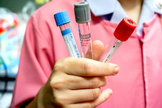 Closeup and crop Medical Blood tube on nurse hand