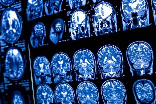 closeup of ct scan with brain medicine science and education mri brain background magnetic resonance imaging tomography shot
