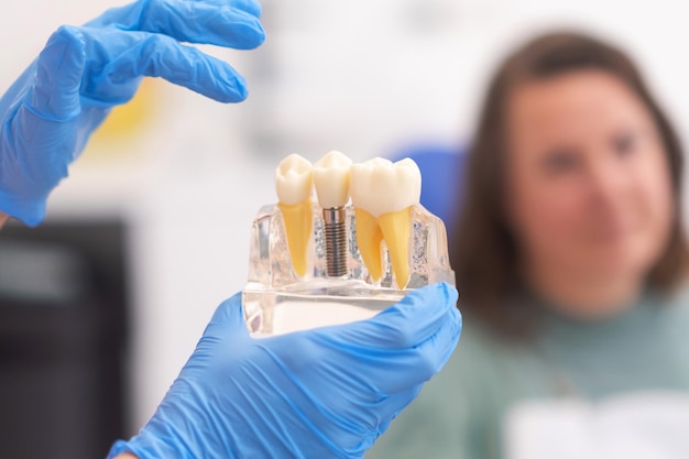 Photo closeup of dental model with implant patient of dental clinic on blurred background dentistry