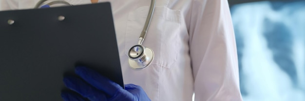 Closeup of doctor with clipboard filling form of patient radiologist or pulmonologist office