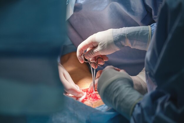 Closeup of doctors hands operating a patient conducting open cut surgery in surgical room Healthcare and medical intervention concept