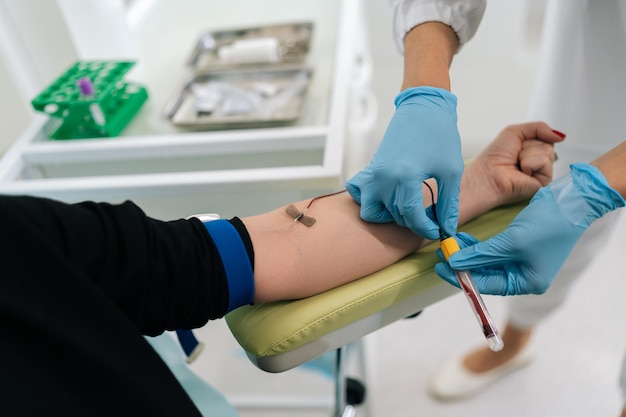 Foto close-up di una lavoratrice di laboratorio con guanti medici blu che raccoglie un campione o un campione di sangue da