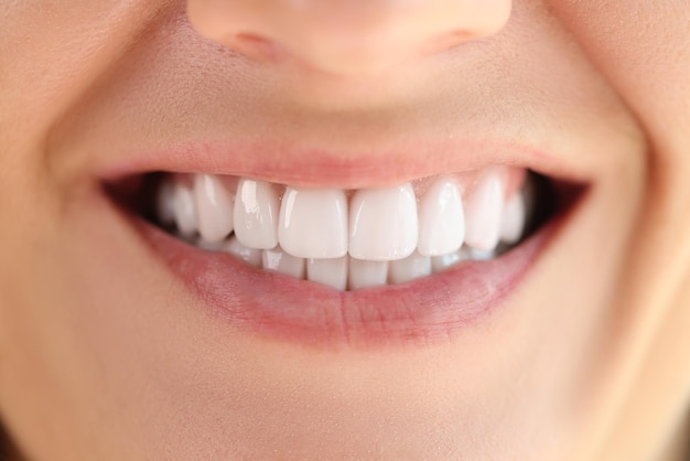 건강한 부드러운 하얀 치아 미소의 근접 촬영