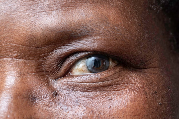 a closeup and macro view on the eye of an elderly black man a cloudy film
