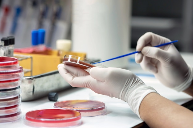 Photo closeup the media plate on hand medical technicians working on bacterial culture and drug