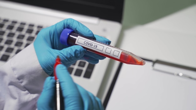 Closeup of microbiologist or medical worker hand with blue surgical gloves marking blood test result as positive for the new rapidly spreading Coronavirus. COVID-19 Positive concept