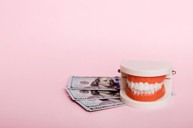 Closeup model of a human jaw with white teeth and dollar bill Dentistry conceptual photo Prosthetic dentistry False teet top view with copy space