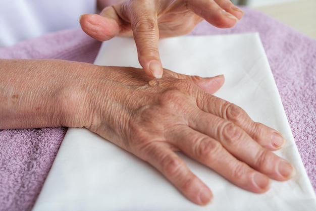クローズ アップ古い女性の手の祖母は、関節炎の温暖化軟膏をこすります
