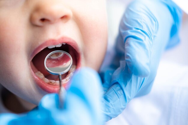 Foto primo piano bocca aperta bambino e specchio nelle mani dei dentisti in guanti blu checkup esaminare il trattamento dei denti per l'igiene dentale dei bambini di assistenza sanitaria